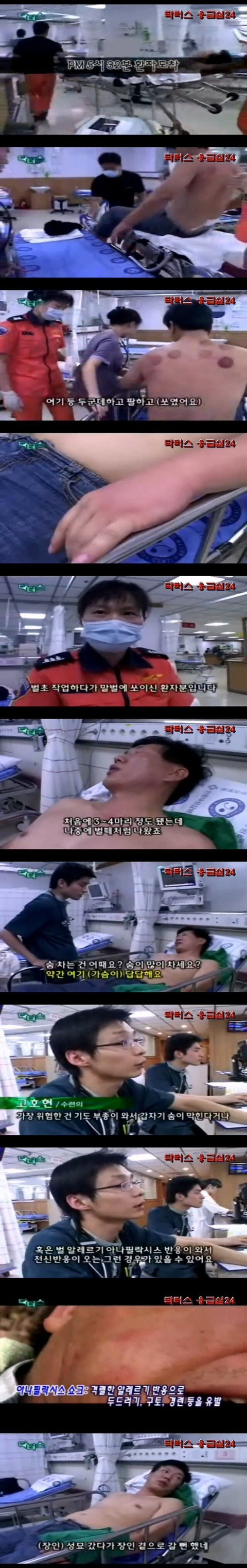 말벌에 쏘여 응급실에 온 환자의 드립 | 인스티즈