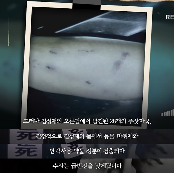 김성재 오른팔에서 발견된 28개의 주삿자국 | 인스티즈